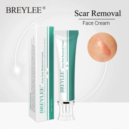Breylee Acne Scar Removal Cream In Pakistan